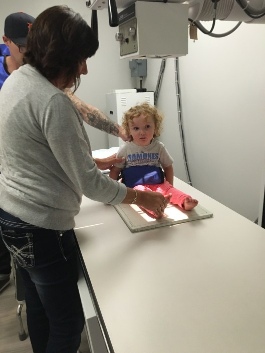 Nothing broken, but she didn't walk for almost two weeks. So brave.